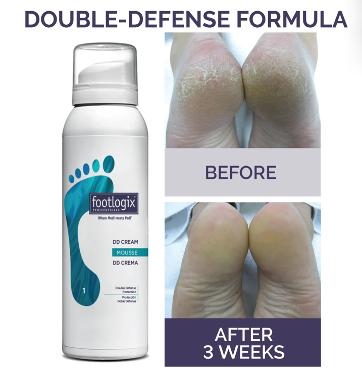 Footlogix® DD Cream Mousse Formula, 125ml